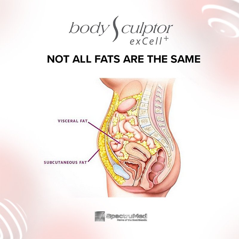 BodySculptor 5-Not all fats are the same