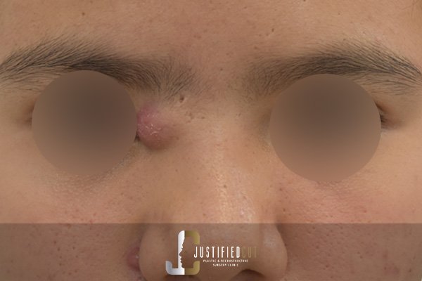 Justified Cut Before ECI